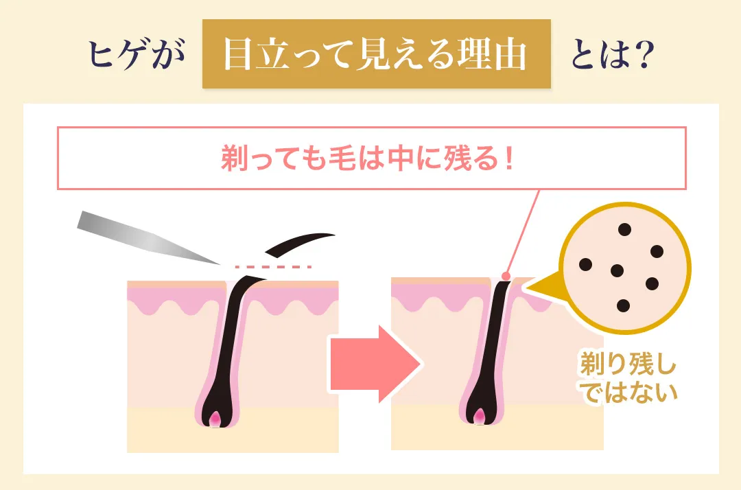 ヒゲが目立って見える仕組みを解説した画像