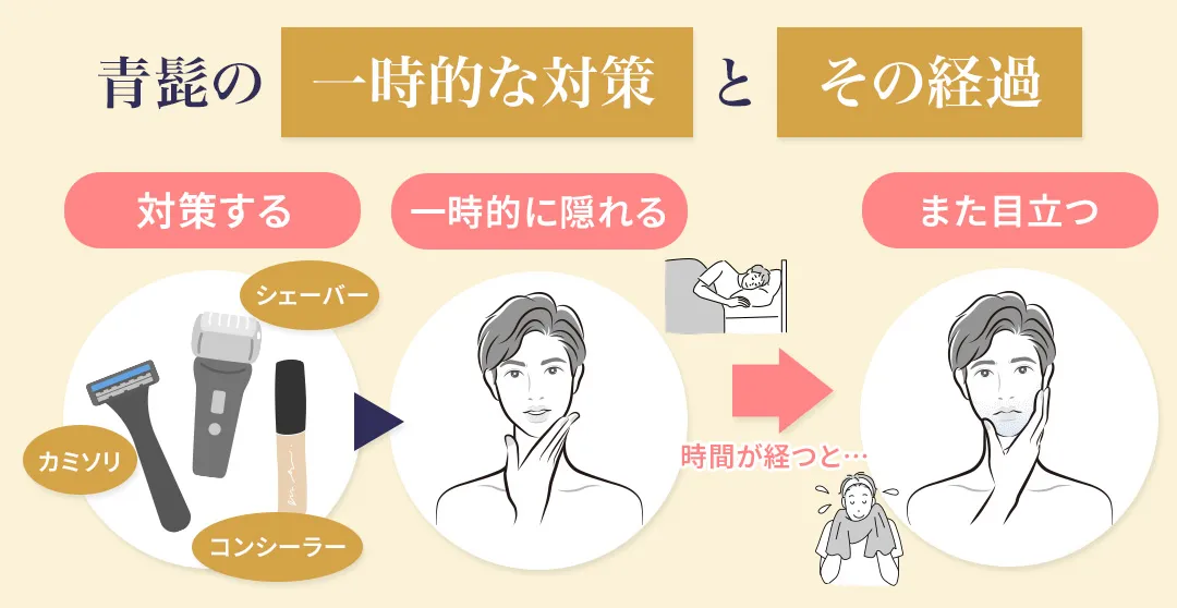 青髭を一時的に解消する方法とその経過を解説した画像
