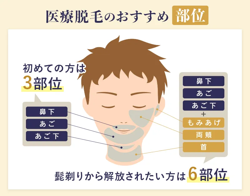ヒゲ脱毛の部位別でのおすすめプランを解説した画像