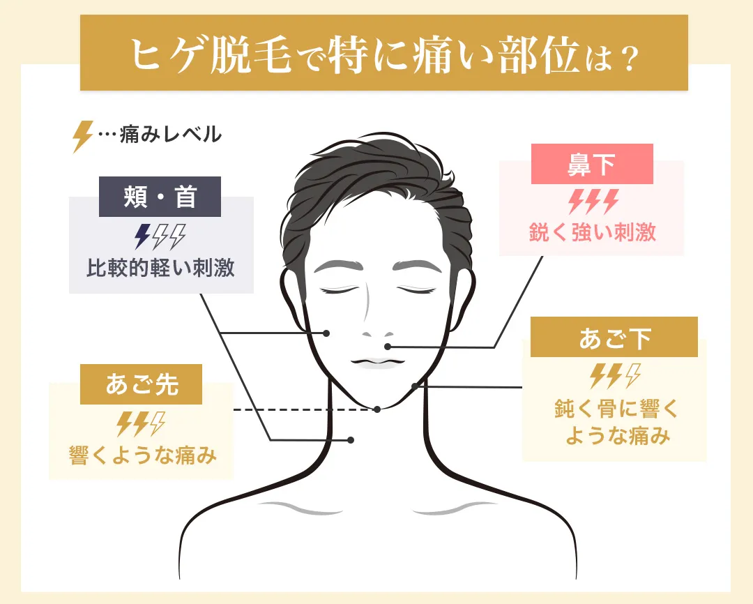 ヒゲ脱毛の痛みが強い部位を比較