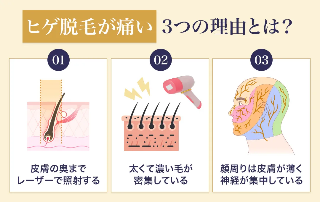 ヒゲ脱毛が痛い3つの理由
