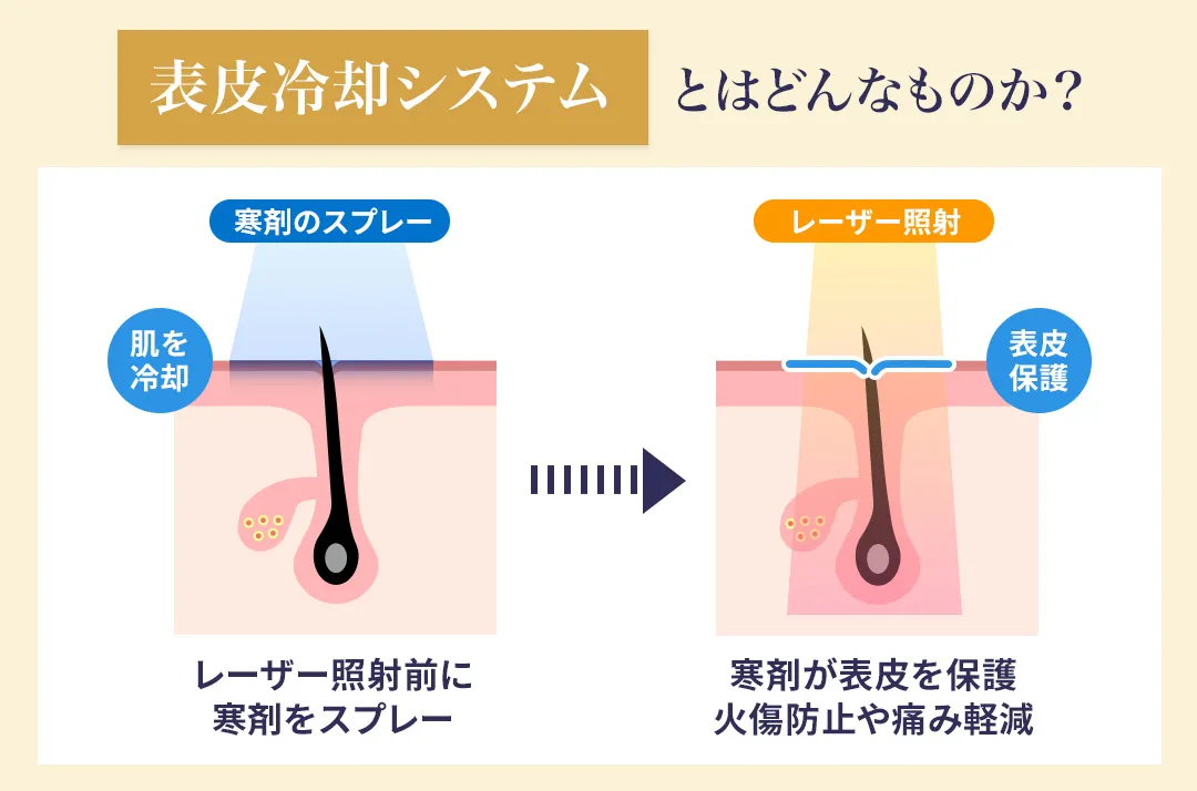 ジェントルマックスプロ独自の冷却システム