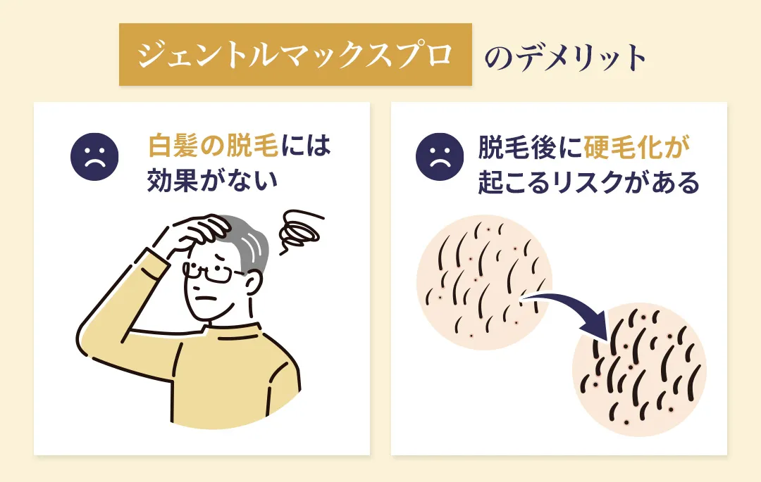 ジェントルマックスプロで脱毛するデメリット