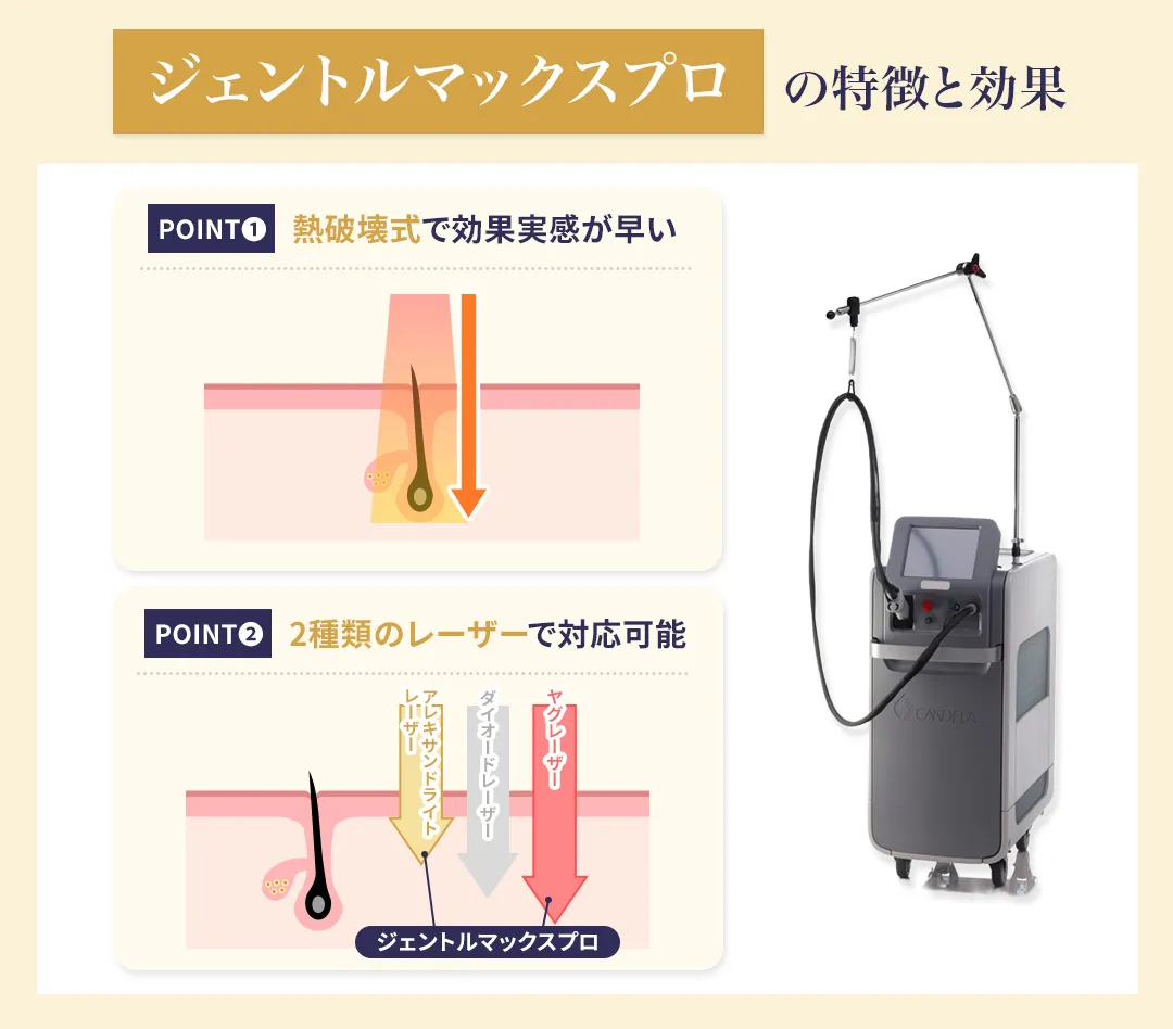 ジェントルマックスプロの脱毛効果