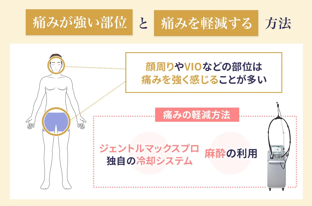 ジェントルマックスプロの痛みが強い部位と軽減する方法