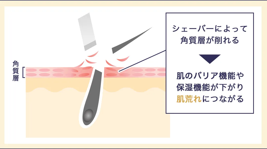 髭剃りにより肌荒れが起こる原因