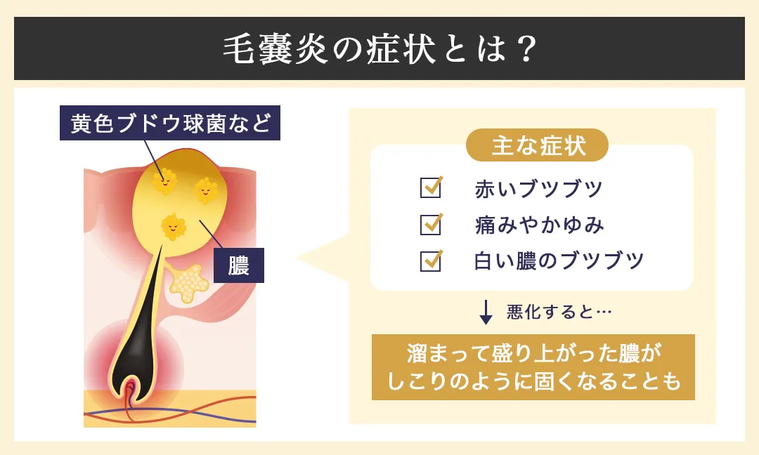毛嚢炎の説明部分
