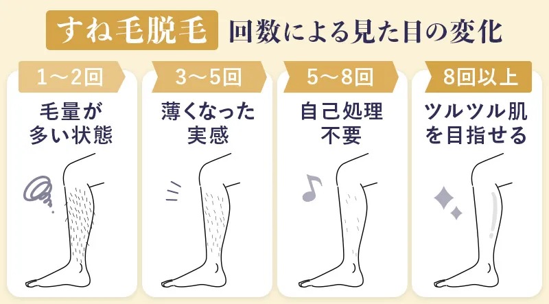 メンズのすね毛脱毛をクリニックで行った際の施術回数
