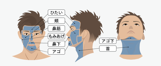 ヒゲ脱毛の施術範囲のイメージ