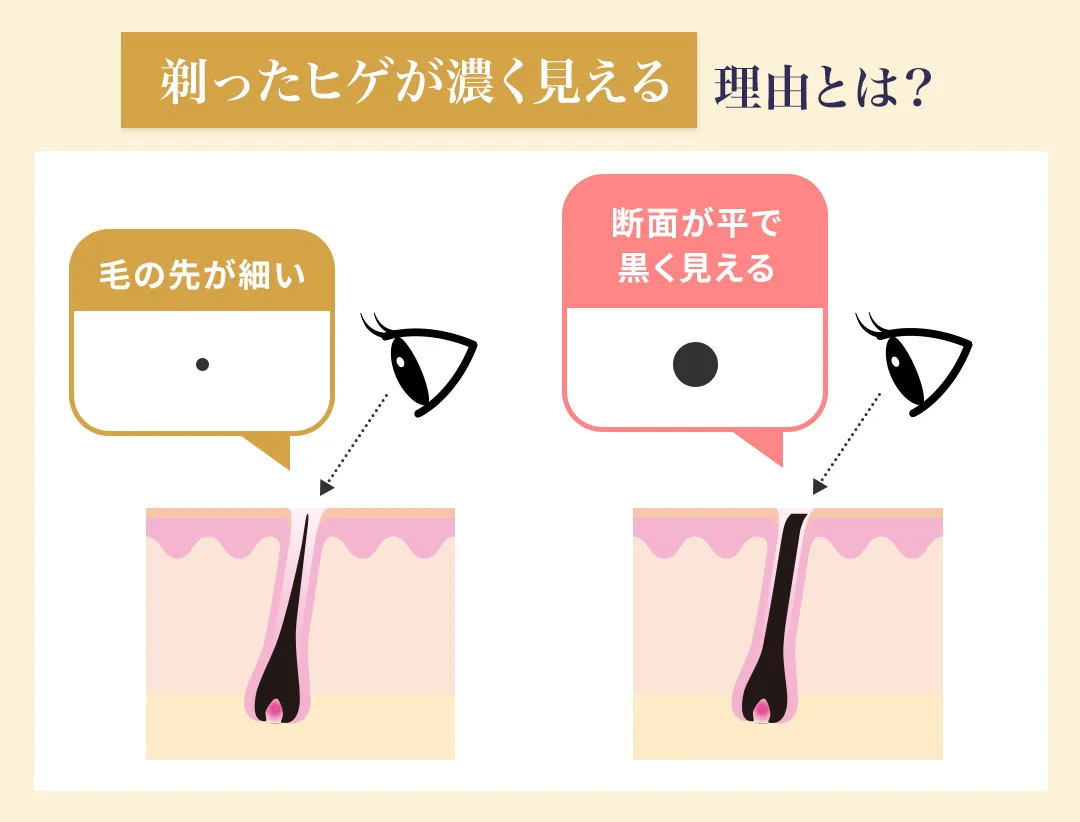 髭剃り後に断面が露出することで濃く見える