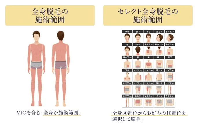 エミナルクリニックメンズ全身脱毛の施術範囲