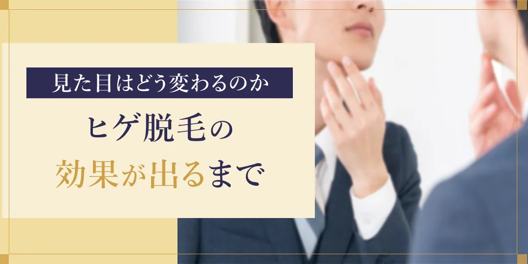 ヒゲ脱毛の効果が出るまでの経過