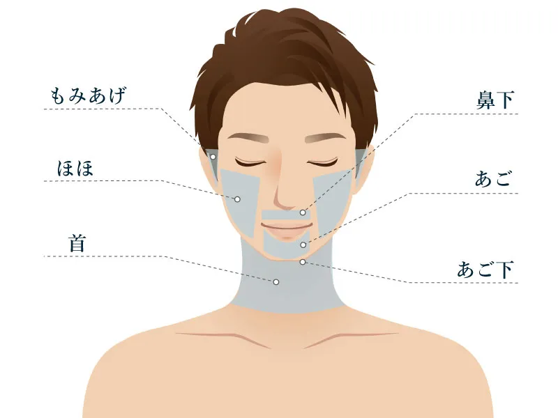 エミナルクリニックのヒゲ脱毛の施術範囲