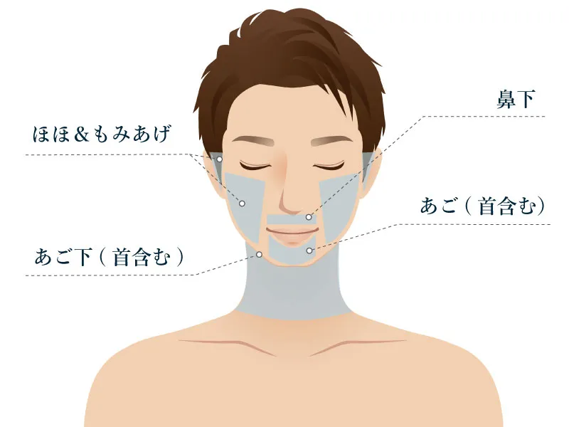 メンズリゼのヒゲ脱毛の施術範囲