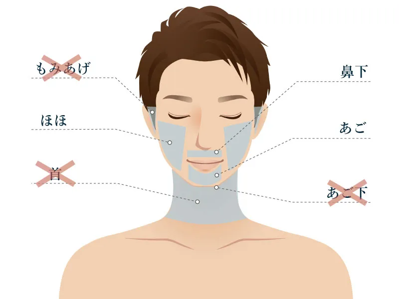 リアラクリニックのヒゲ脱毛の施術範囲