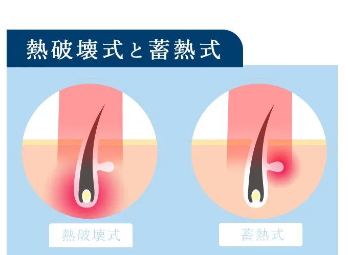 熱破壊式と蓄熱式の違い